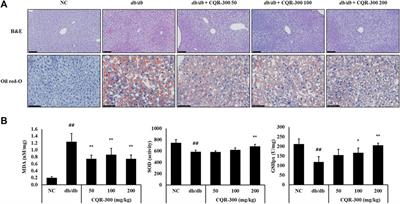 Anti-hyperglycemic effects of Cissus quadrangularis extract via regulation of gluconeogenesis in type 2 diabetic db/db mice